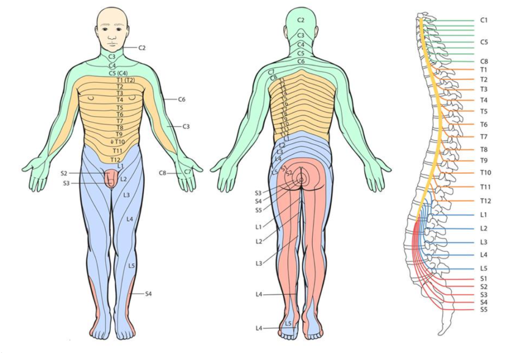 Ilustración de dermatomos que muestra cómo el dolor de codo, rodilla o pie puede tener origen en la espalda