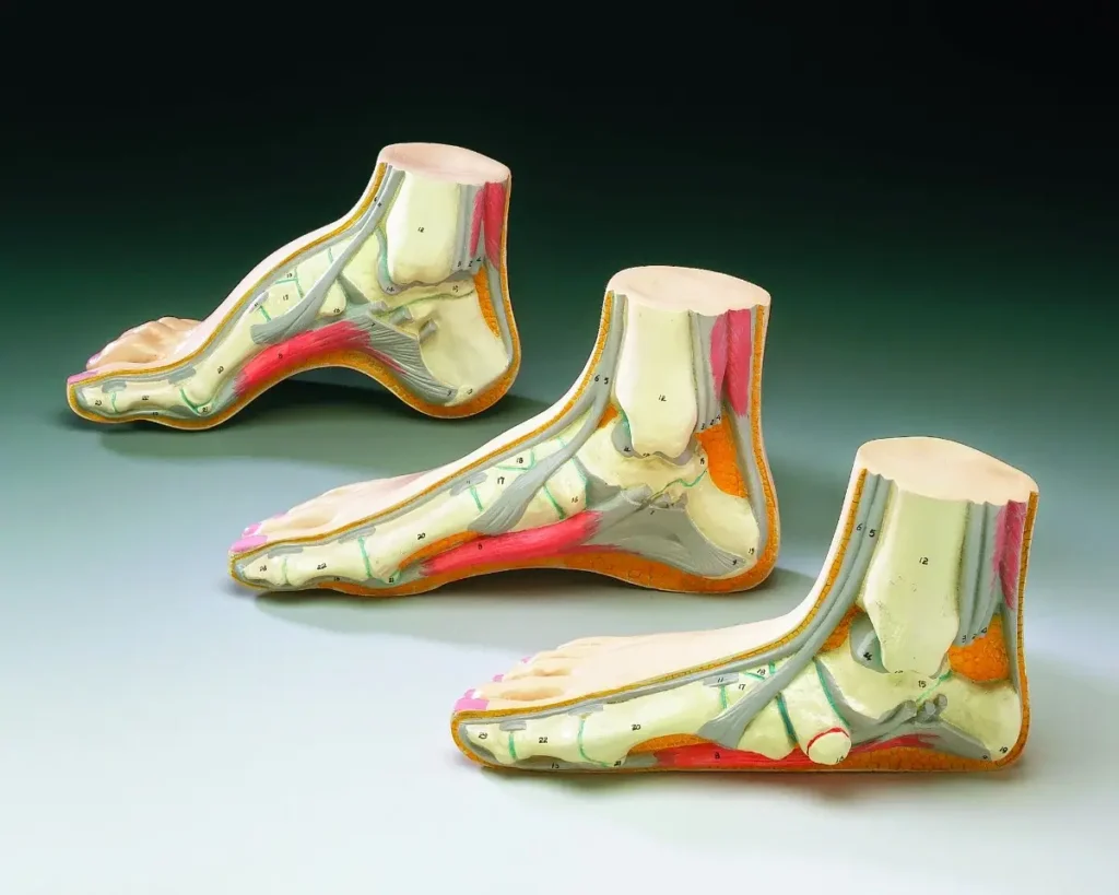 fascitis-plantar-dolor-talon